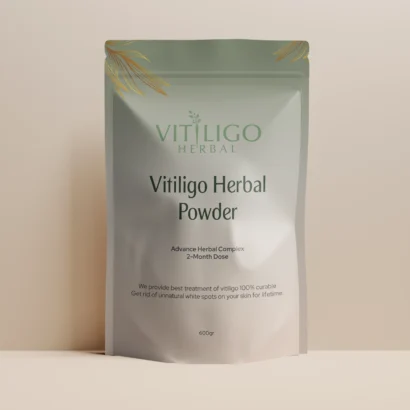 Vitiligo Herbal featured image