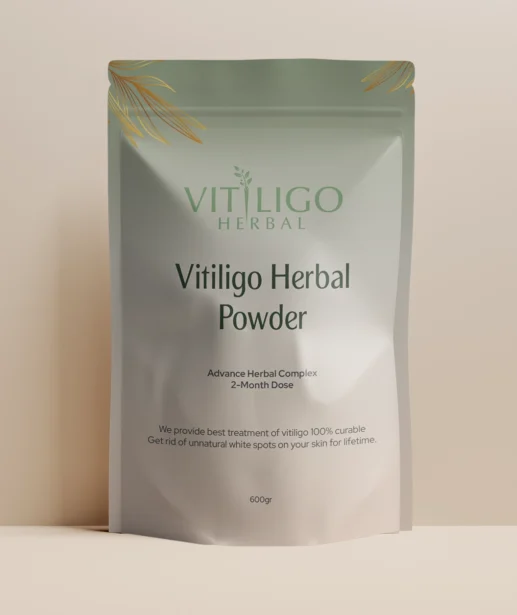 Vitiligo Herbal featured image