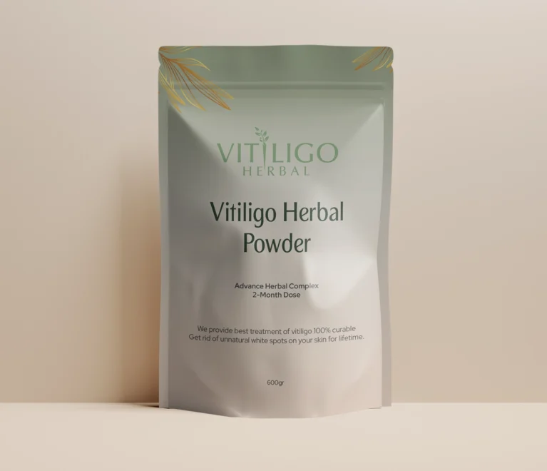 Vitiligo Herbal featured image