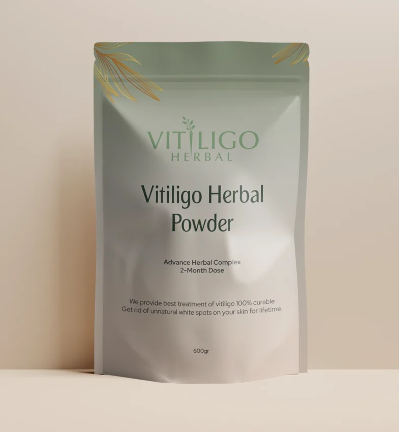 Vitiligo Herbal featured image